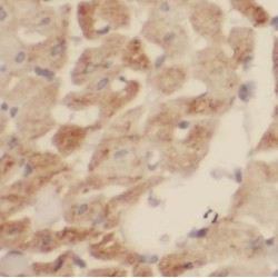 Succinate Dehydrogenase Complex Subunit B (SDHB) Antibody