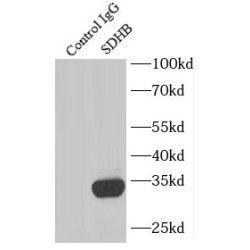 Succinate Dehydrogenase Complex Subunit B (SDHB) Antibody