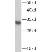 WB analysis of HEK-293 cells, using SDHB antibody (1/1000 dilution).