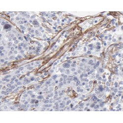 Succinate Dehydrogenase Complex Subunit C (SDHC) Antibody