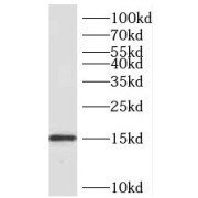 WB analysis of human liver tissue, using SDHC antibody (1/400 dilution).