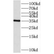 WB analysis of human adrenal gland tissue, using SDR39U1 antibody (1/500 dilution).