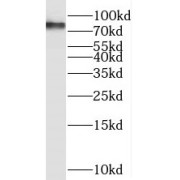 WB analysis of Y79 cells, using SEC14L1 antibody (1/300 dilution).