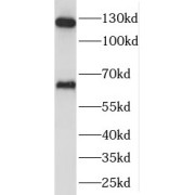 WB analysis of human liver tissue, using SEC24A antibody (1/500 dilution).