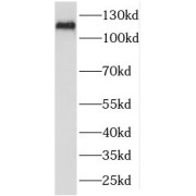 WB analysis of HeLa cells, using SEC24C antibody (1/500 dilution).