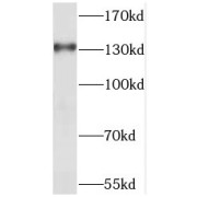 WB analysis of HeLa cells, using SEC31A antibody (1/500 dilution).