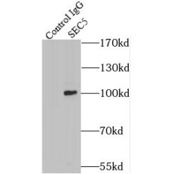 Exocyst Complex Component 2 (EXOC2) Antibody