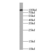 WB analysis of mouse brain tissue, using SEC5/EXOC2 antibody (1/5000 dilution).