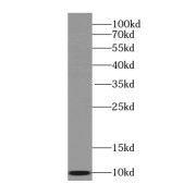 WB analysis of mouse liver tissue, using SEC61B-Specific antibody (1/500 dilution).