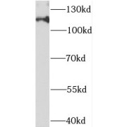 WB analysis of Jurkat cells, using EXOC4 antibody (1/300 dilution).