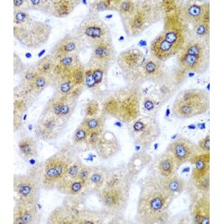 Selenocysteine Insertion Sequence-Binding Protein 2 (SECISBP2) Antibody