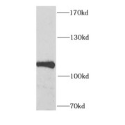 WB analysis of HeLa cells, using SECISBP2 antibody (1/1000 dilution).