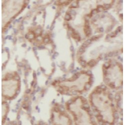 Semenogelin I (SEMG1) Antibody