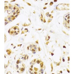 Selenide, Water Dikinase 1 (SEPHS1) Antibody