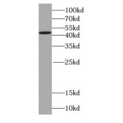 WB analysis of HEK-293 cells, using SEPT2 antibody at various dilutions.