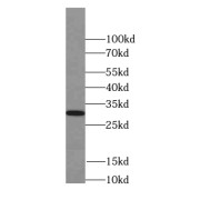 WB analysis of A375 cells, using SEPT4 antibody (1/300 dilution).