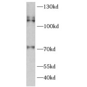 WB analysis of HeLa cells, using SERCA2 antibody (1/1000 dilution).