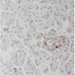 SERCA3 Antibody