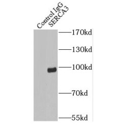 SERCA3 Antibody