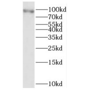 WB analysis of mouse skeletal muscle tissue, using ATP2A3 antibody (1/500 dilution).