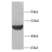 WB analysis of human liver tissue, using SERPINA10 antibody (1/1000 dilution).