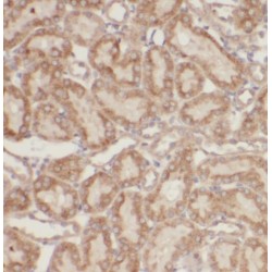 Corticosteroid Binding Globulin (SERPINA6) Antibody