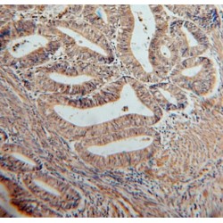 Serpin Family B Member 2 (SERPINB2) Antibody