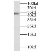 WB analysis of Jurkat cells, using SERPINB2 antibody (1/400 dilution).