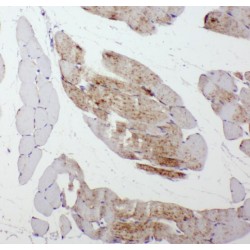 Serpin B6 (SERPINB6) Antibody