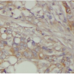 Sestrin 2 (SESN2) Antibody