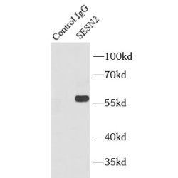 Sestrin 2 (SESN2) Antibody