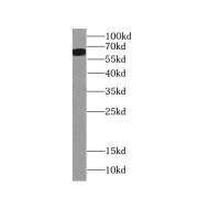 WB analysis of mouse thymus tissue, using Sestrin 2 antibody (1/500 dilution).