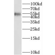 WB analysis of RAW 264.7 cells, using SETD6 antibody (1/600 dilution).