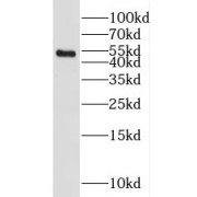 WB analysis of mouse kidney tissue, using SETD7 antibody (1/1000 dilution).