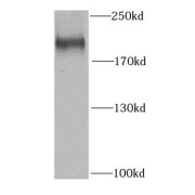 WB analysis of MCF7 cells, using SETDB1 antibody (1/1000 dilution).