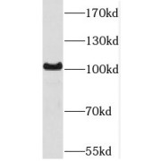 WB analysis of Jurkat cells, using SETDB2 antibody (1/300 dilution).