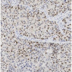 Splicing Factor 3A Subunit 1 (SF3A1) Antibody