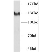 WB analysis of K-562 cells, using SF3A1 antibody (1/1000 dilution).