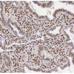 Splicing Factor 3A Subunit 2 (SF3A2) Antibody