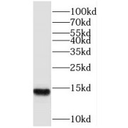 WB analysis of HeLa cells, using SF3B14 antibody (1/2000 dilution).