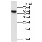 WB analysis of HeLa cells, using SF3B4 antibody (1/500 dilution).