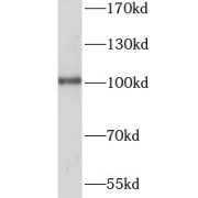 WB analysis of NIH/3T3 cells, using SFMBT2 antibody (1/600 dilution).