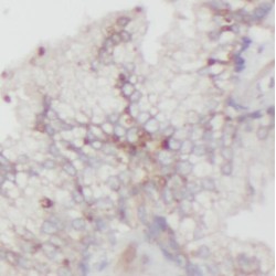 SURP And G-Patch Domain Containing 2 (SFRS14) Antibody