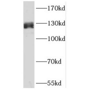 WB analysis of mouse testis tissue, using SFRS14 antibody (1/500 dilution).