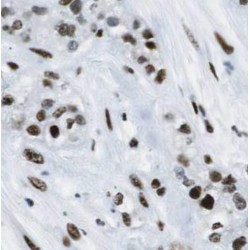 Splicing Factor, Arginine/serine-Rich 17A (SFRS17A) Antibody