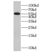 WB analysis of HeLa cells, using SFRS6 antibody (1/600 dilution).