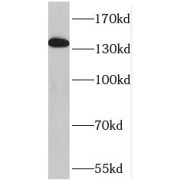 WB analysis of Jurkat cells, using SFRS8 antibody (1/2000 dilution).