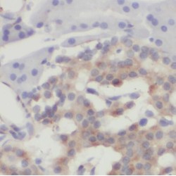 SFT2 Domain Containing 3 (SFT2D3) Antibody