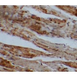 Pulmonary Surfactant-Associated Protein B (SFTPB) Antibody