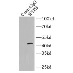 Pulmonary Surfactant-Associated Protein B (SFTPB) Antibody